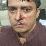 স্বাধীন কণ্ঠের বার্তা সম্পাদক ও  দৈনিক গণজাগরণ পত্রিকার সাংবাদিক  ফরহাদ আহমেদ প্রধান এর উপর এলোপাতাড়ি হামলা