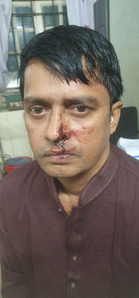 স্বাধীন কণ্ঠের বার্তা সম্পাদক ও দৈনিক গণজাগরণ পত্রিকার সাংবাদিক ফরহাদ আহমেদ প্রধান এর উপর এলোপাতাড়ি হামলা