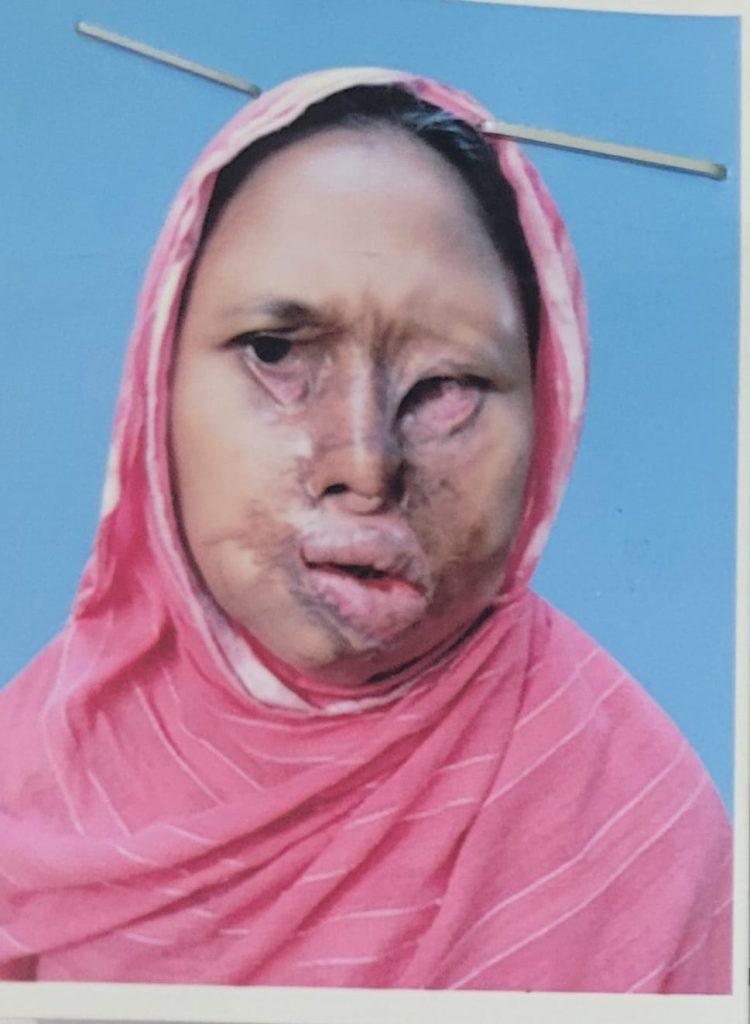 আন্তর্জাতিক নারী দিবসে ‘অদম্য নারী’ সম্মাননা পেলেন সংগ্রামী নারী শমলা বেগম।