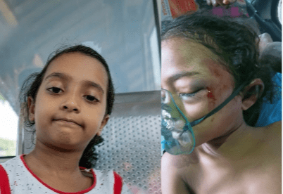 দাউদকান্দিতে ৮ বছরের শিশু হাবিবা আপন চাচাতো ভাইয়ের পাশবিক নির্যাতনের শিকার