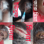 দাউদকান্দির ঝাউতলী গ্রামের ঝাড়ু মিয়া সহ ছেলে -মেয়ের উপর দেশীয় ধারালো অস্ত্র দিয়ে এলোপাতাড়ি হামলা করা দুষ্কৃতকারীদের দ্রুত গ্রেফতার করার দাবি করেন এলাকাবাসি