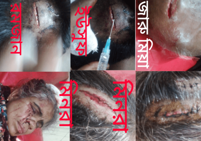 দাউদকান্দির ঝাউতলী গ্রামের ঝাড়ু মিয়া সহ ছেলে -মেয়ের উপর দেশীয় ধারালো অস্ত্র দিয়ে এলোপাতাড়ি হামলা করা দুষ্কৃতকারীদের দ্রুত গ্রেফতার করার দাবি করেন এলাকাবাসি