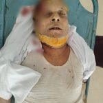 সীতাকুণ্ডে সড়ক দুর্ঘটনায় বৃদ্ধ নিহত, ঘাতক গাড়ি পালিয়ে যায়