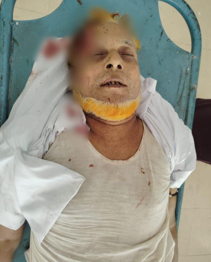 সীতাকুণ্ডে সড়ক দুর্ঘটনায় বৃদ্ধ নিহত, ঘাতক গাড়ি পালিয়ে যায়